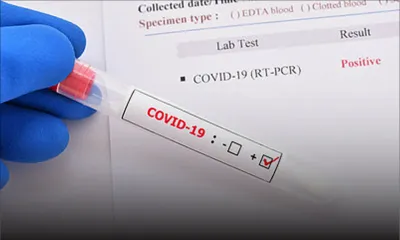 Baptisé Khosta-2 : un virus résistant aux vaccins anti-Covid fait son apparition