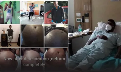 Opération en Inde : atteint de paralysie abdominale, Avinash demande de l’aide