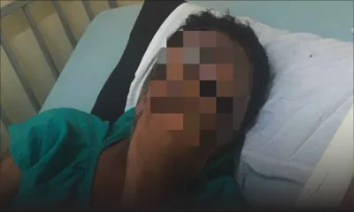 Agression à l’acide à Petit-Raffray: il perd la vue à cause d’une liaison