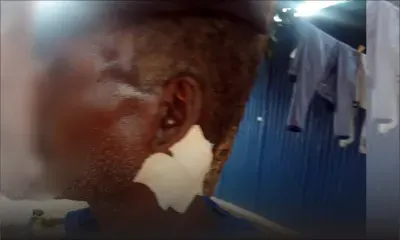 Vengeance : Agressé au cou à l’arme blanche un invalide frôle la mort