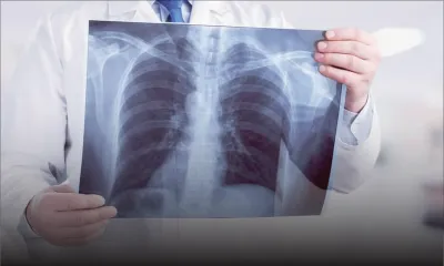 Contrats publics : l’IRP reproche à la Santé son absence de rigueur