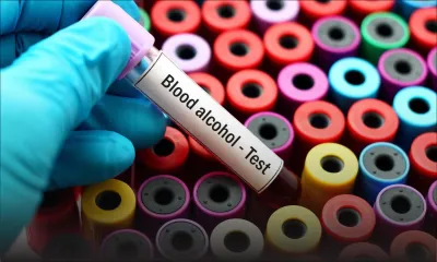 Accident à Quatre-Cocos : le motocycliste avait 144 mg d’alcool dans le sang