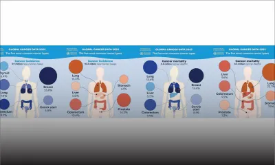 Cancer : légère baisse du nombre de nouveaux cas