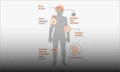Virus : avis divergents sur le risque que la dengue ne devienne endémique