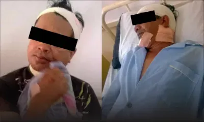 Après une réunion du MSM à Rose-Belle: un activiste orange agressé au cutter