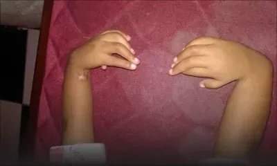 À l’hôpital du Nord : l’opération d’un enfant reportée trois fois