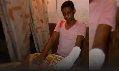 Accident de travail : Joseph a quatre doigts sectionnés