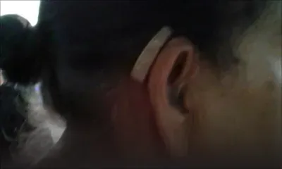 Sécurité sociale : les appareils auditifs bientôt disponibles de nouveau