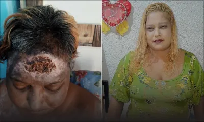 Décès de Faeza Rawa après une attaque au cocktail Molotov 