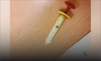 Un corps étranger dans une dinde : l’importateur explique que c’est un ‘timer’