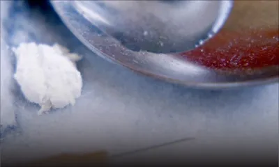 Importation de Rs 7,5 M d’héroïne: le Dr Manish Naga se défend