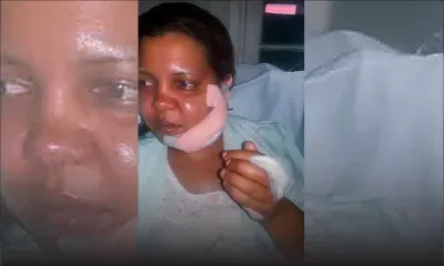 Corine Fra agressée au visage par son mari : «Je dois la vie à ma fille»