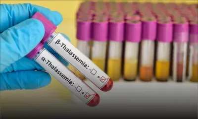 Thalassémie : vers la mise en place d’un nouveau protocole de traitement