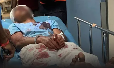 Trois femmes sauvagement agressées à Pailles : l’une d’elles dans un état grave, avec une fracture de la colonne vertébrale