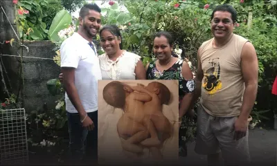 Séparé de son frère siamois - Ashlay Fokeer, 26 ans : «Je suis un survivant»