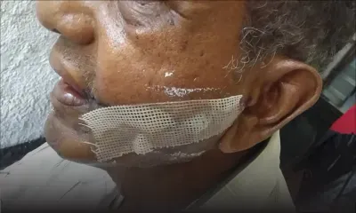 Pour une simple histoire de pain : un sexagénaire agressé au visage à coups de cutter