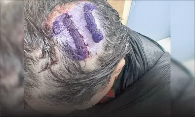 Nuit sanglante à Plaine-Verte : une femme scalpée à coups de sabre, deux hommes blessés