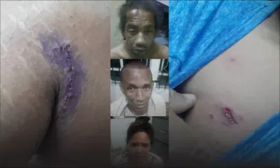 Un policier agressé à la poitrine, un autre mordu au bras et au cou