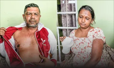 Sashi Jhingoor : «Sa sikatris lor mo figir-la pou res enn mark a vi»