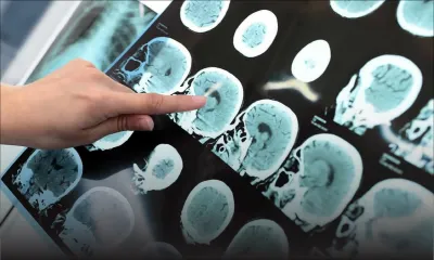 Dr Poonam Bissessur, psychiatre : «La cause de l’épilepsie inconnue dans 60 % des cas»