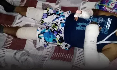 Dans le Nord : une querelle de voisinage dégénère en violente agression