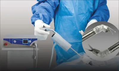 Chirurgie : les avantages de la laparoscopie 