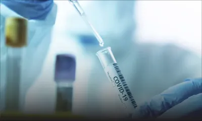 COVID-19 : une réglementation des prix des tests PCR souhaitée