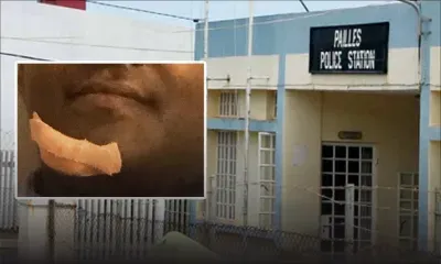 Un homme tente d’égorger un constable : une intervention policière qui finit en sang 