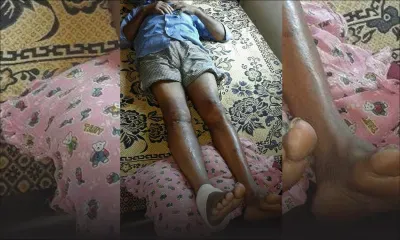 Victime d’un accident à Souillac: Suren réclame des indemnisations