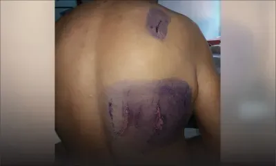 Hôpital Brown-Séquard : Il allègue que son frère a été frappé par le personnel 