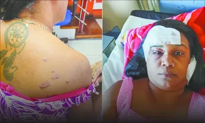 Violence domestique - Madvi : «Mo ti krwar mo pou mor sa zour-la»