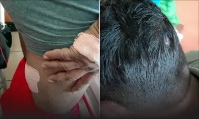 Nouvelle-France – Le propriétaire d’une station-service agressé avec une « fouine »