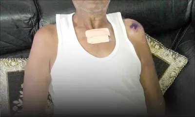 Un taximan séquestré: un agresseur lynché à Camp-Chapelon