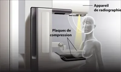 Appareil de mammographie en panne : une centaine de patientes dans l’incertitude