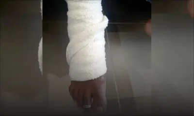 Près d’un centre commercial à Riche-Terre : une gérante de 51 ans attaquée et dépouillée de Rs 80 000