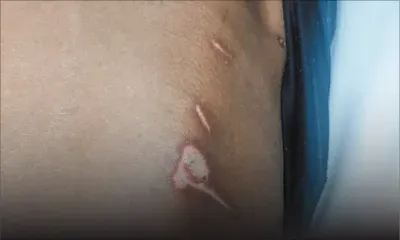 Un retraité retrouvé en sang dans sa maison : soupçonnant une agression, la famille demande d’approfondir l’enquête