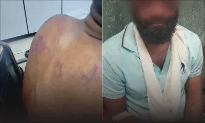 Arrestation musclée à Port-Louis : un homme de 32 ans crie à la brutalité policière 