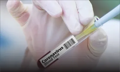 Santé - COVID-19 : l’accord qui garantit un vaccin à 20 % de la population