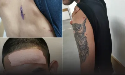 En revenant de la boutique à Vallée-Pitot : un jeune agressé et dépouillé à coups d’arme tranchante