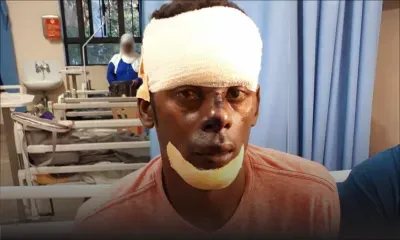 À Albion : il fracasse le crâne d’un skipper à coups de brique