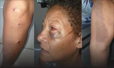 Avenue Berthaud, Quatre-Bornes - Brigitte, 58 ans, allègue : «J’ai été rouée de coups à cause d’une histoire d’héritage» 