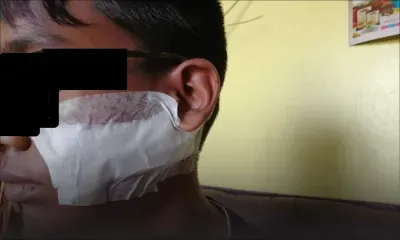 Agression au cutter dans un collège : un ado de 14 ans s’en sort avec 20 points de suture 