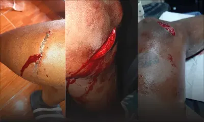 Violence domestique : un homme de 22 ans lynché après avoir agressé sa compagne