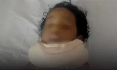 Lors d’une bagarre : un bébé blessé par un coup de sabre