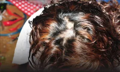 Soupçons d’infidélité: elle est menacée de mort et a les cheveux arrachés