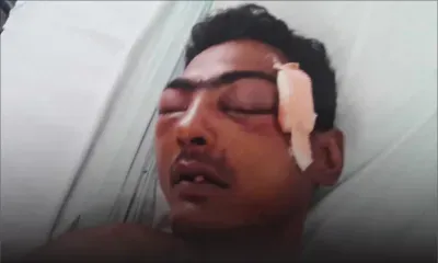 Son mari en soins intensifs : l’épouse crie à la «brutalité policière»