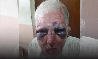 Agression : le calvaire de Tibye Najim, 66 ans, agressé à coups de pierre