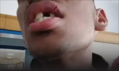 Agression dans un collège d’État : il perd une dent, sa sœur réclame des sanctions