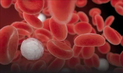 La Journée de l’hémophilie observée de manière virtuelle vendredi 