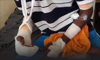 Battu depuis dix ans : le mari séquestré et agressé à coups de couteau par sa femme